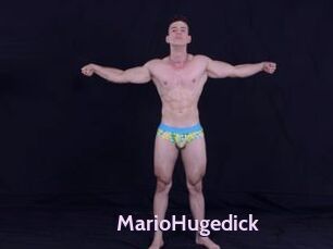 MarioHugedick